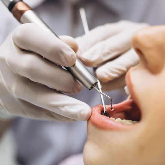 Dental Instruments 